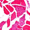 9A-Tendon-insertion-site-Case-9-H-E-5.jpg