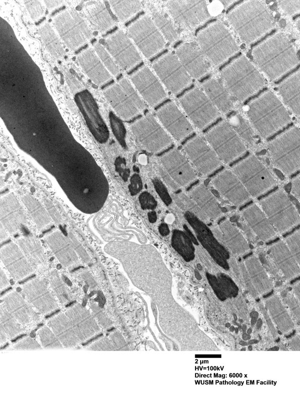 2D1A-Case-2-EM004-Copy.jpg