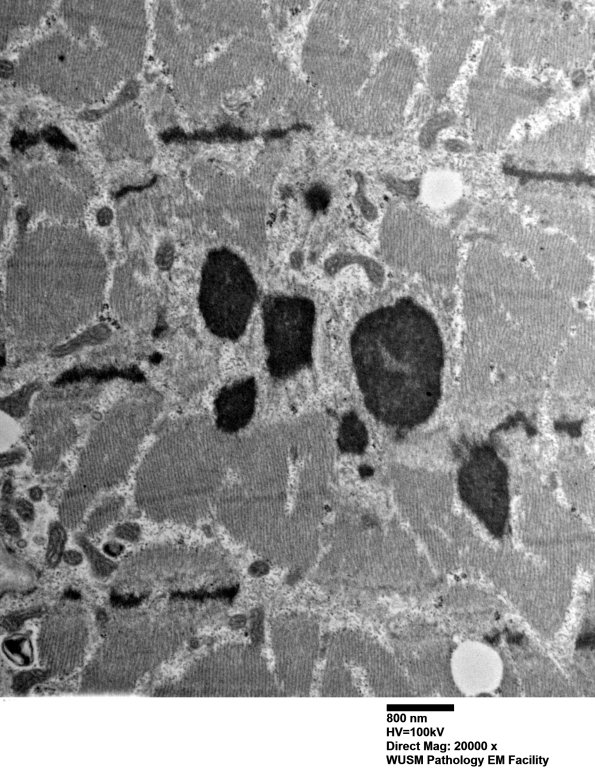 3D4-Case-3-EM019-Copy.jpg