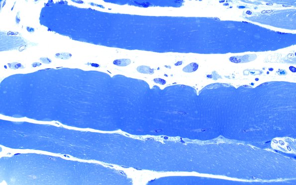 4A (Case 4) 40X 1