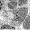 1A1 Normal, NMJ (Case 1) EM  039 - Copy