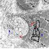 1A2B Normal, NMJ (Case 1) EM  040 copy copy - Copy
