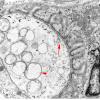 1A5 Normal, NMJ (Case 1) EM  043 copy - Copy