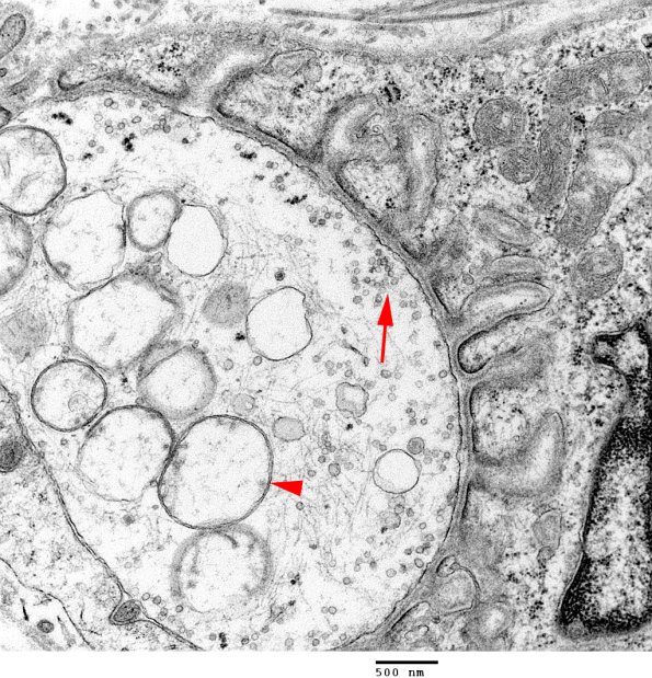 1A5 Normal, NMJ (Case 1) EM  043 copy - Copy