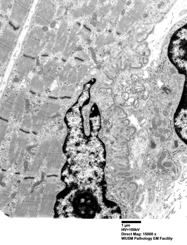2A1 (Case 2) Muscle EM005 - Copy