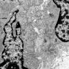 2A2 (Case 2) Muscle EM008 - Copy
