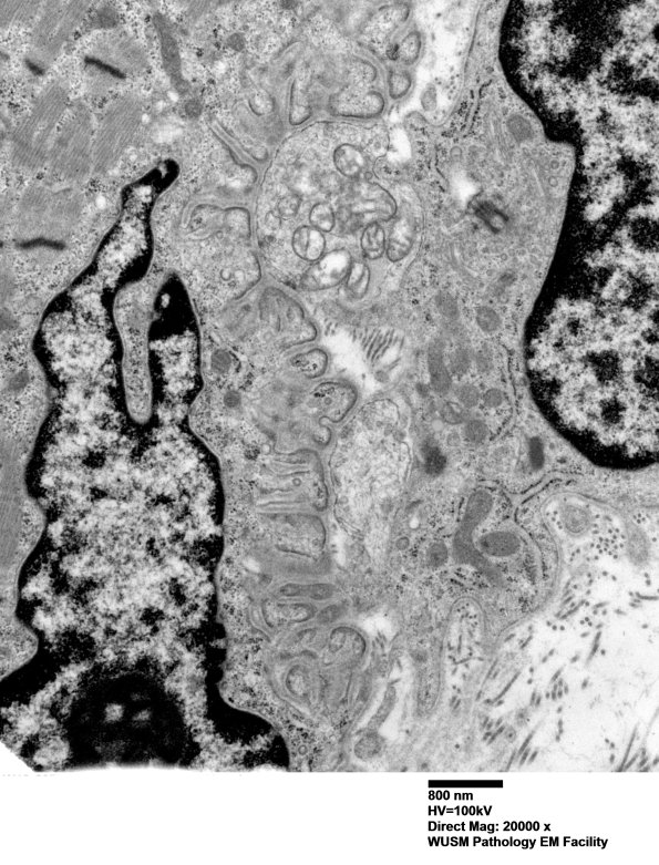 2A2 (Case 2) Muscle EM008 - Copy