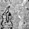2A3 (Case 2) Muscle EM006 - Copy