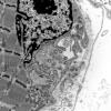 2B2 (Case 2) Muscle EM015 - Copy