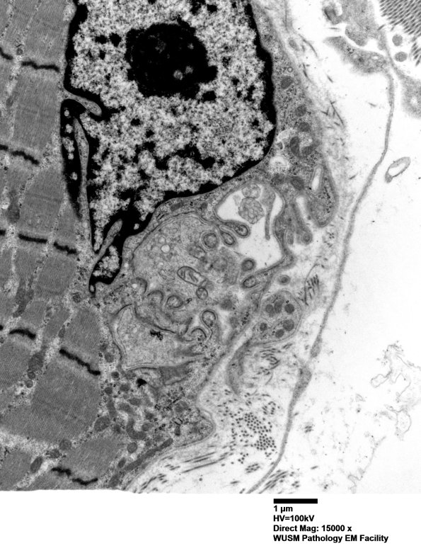 2B2 (Case 2) Muscle EM015 - Copy