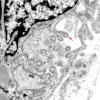 2B3 (Case 2) Muscle EM016 copy - Copy