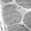 3A1 (Case 3) Muscle EM038 - Copy
