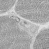 3A2 (Case 3) Muscle EM033 - Copy