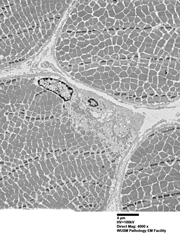3A2 (Case 3) Muscle EM033 - Copy
