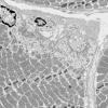 3A3 (Case 3) Muscle EM037 - Copy