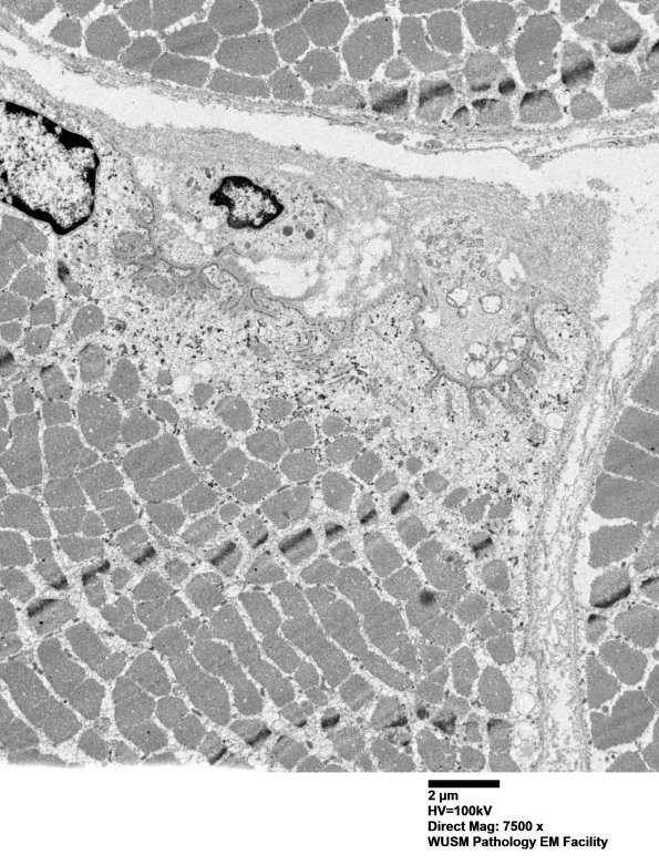 3A3 (Case 3) Muscle EM037 - Copy