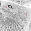 3A4 (Case 3) Muscle EM034 copy - Copy