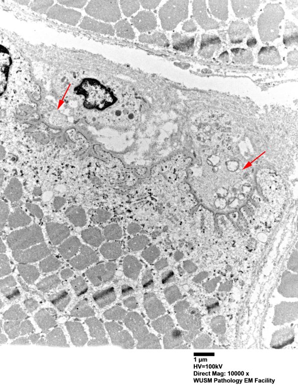 3A4 (Case 3) Muscle EM034 copy - Copy
