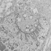 3A5 (Case 3) Muscle EM035 - Copy