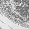 3B1 (Case 3) Muscle EM018 - Copy