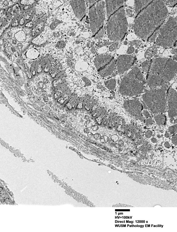 3B1 (Case 3) Muscle EM018 - Copy