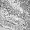 3B2 (Case 3) Muscle EM020 - Copy
