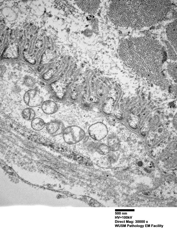3B2 (Case 3) Muscle EM020 - Copy