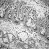 3B3 (Case 3) Muscle EM021 - Copy