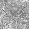 4A1C (Case 4) EM 017 - Copy