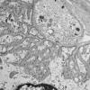 4B2 (Case 4) EM 028 - Copy