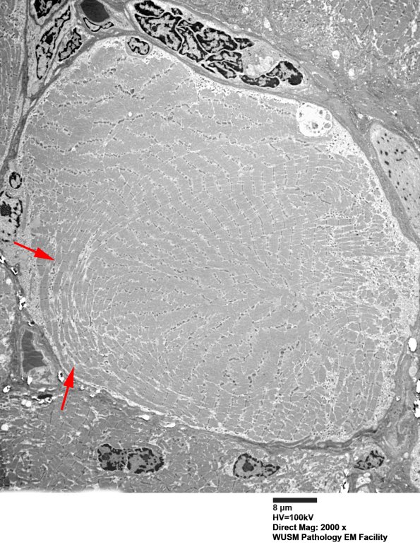1G10A (Case 1) Muscle_014 copy - Copy