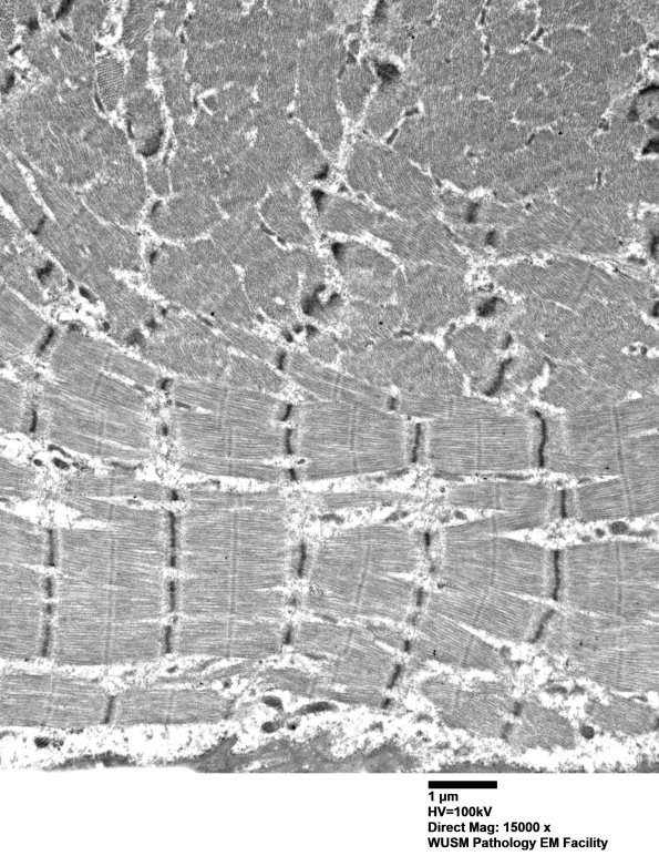 1G10B (Case 1) Muscle_016 - Copy