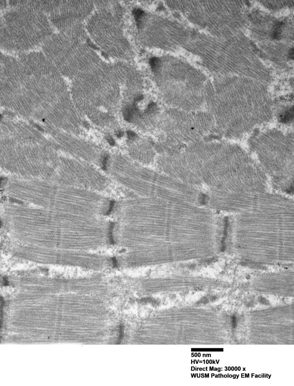 1G10C (Case 1) Muscle_015 - Copy