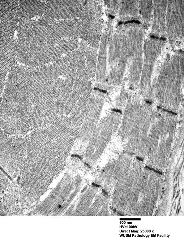1G11B (Case 1) muscle_022 - Copy