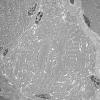 1G1A (Case 1) Muscle_027 - Copy