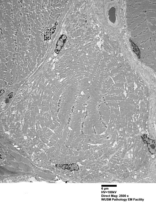 1G1A (Case 1) Muscle_027 - Copy