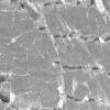 1G1B (Case 1) Muscle_028 - Copy