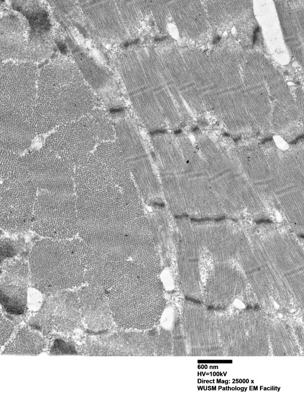 1G1B (Case 1) Muscle_028 - Copy