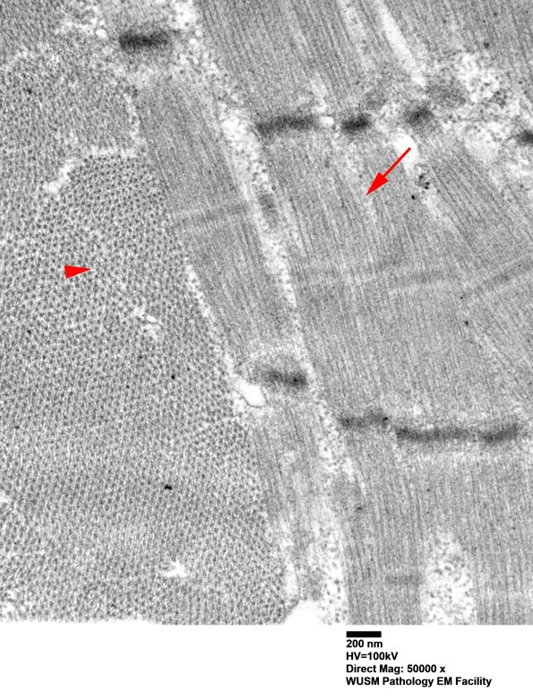 1G1C (Case 1) Muscle_029 copy - Copy