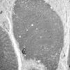 1G2A (Case 1) Muscle_040 - Copy