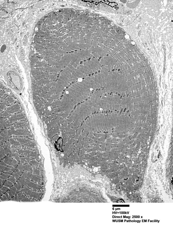 1G2A (Case 1) Muscle_040 - Copy