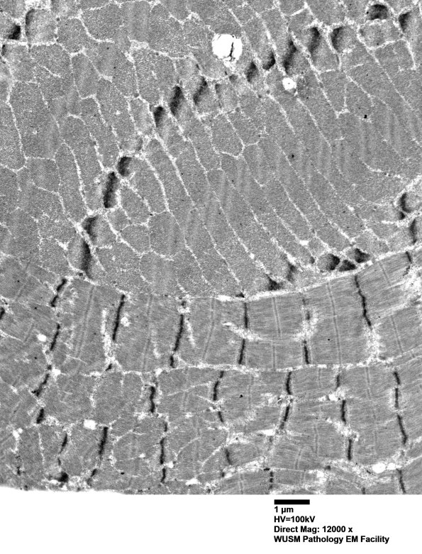 1G2B (Case 1) Muscle_041 - Copy