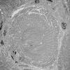 1G3A (Case 1) Muscle_033 - Copy