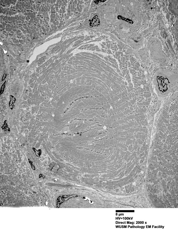 1G3A (Case 1) Muscle_033 - Copy