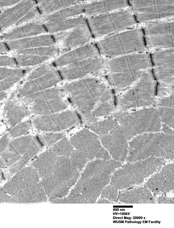 1G3B (Case 1) Muscle_035 - Copy