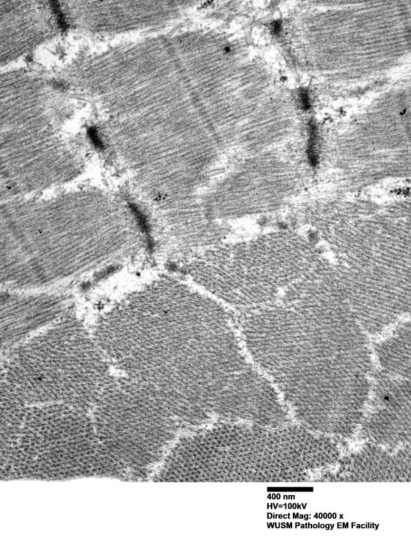 1G3C (Case 1) Muscle_034 - Copy