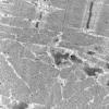 1G4B (Case 1) muscle_044 - Copy