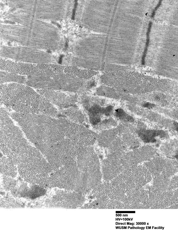 1G4B (Case 1) muscle_044 - Copy