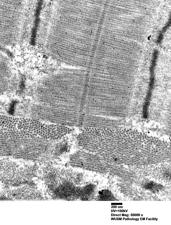 1G4C (Case 1) muscle_045 - Copy