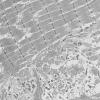 1G5B (Case 1) Muscle_006 - Copy